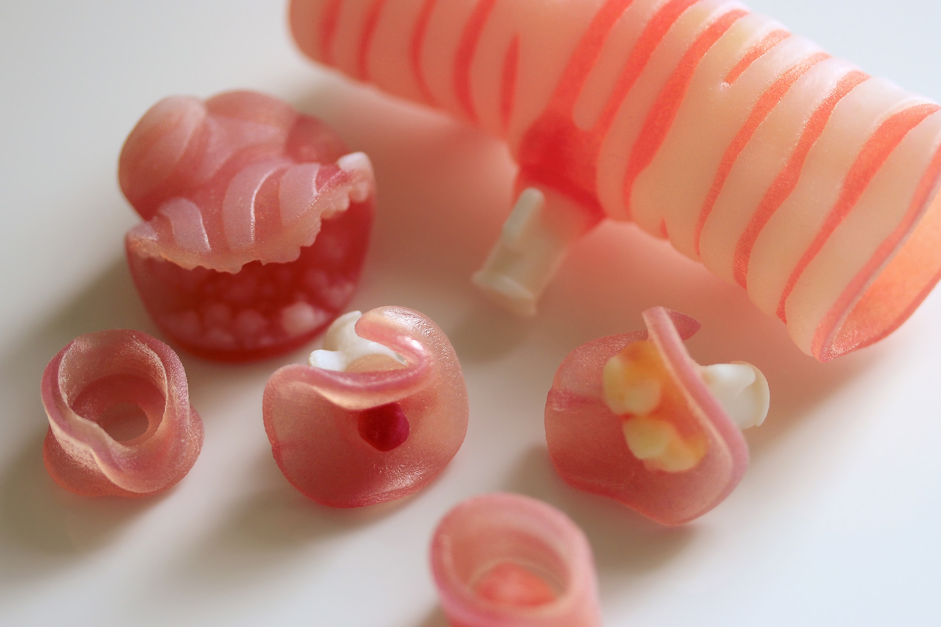 Segments of a 3D printed adult trachea exposing abnormal anatomy inside.