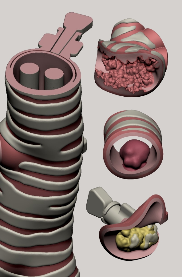 Cross section showing abnormal growths inside.