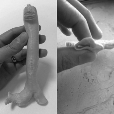 Hand squeezing model of trachea to show its flexible materials.