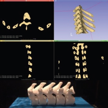 Model of spine sitting on 3D printer bed.